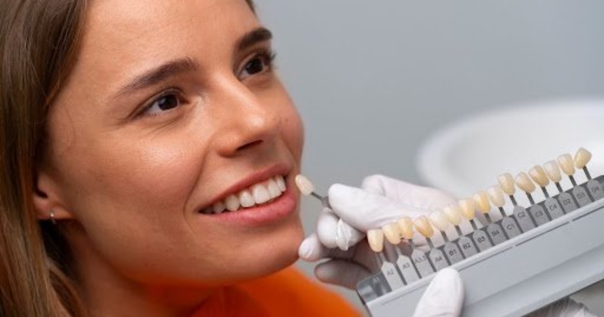 Protect Your Porcelain Veneers: 6 Essential Tips