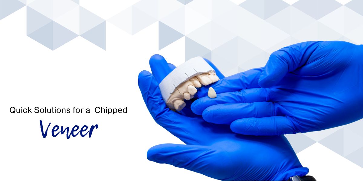 Dental Veneers St Clair