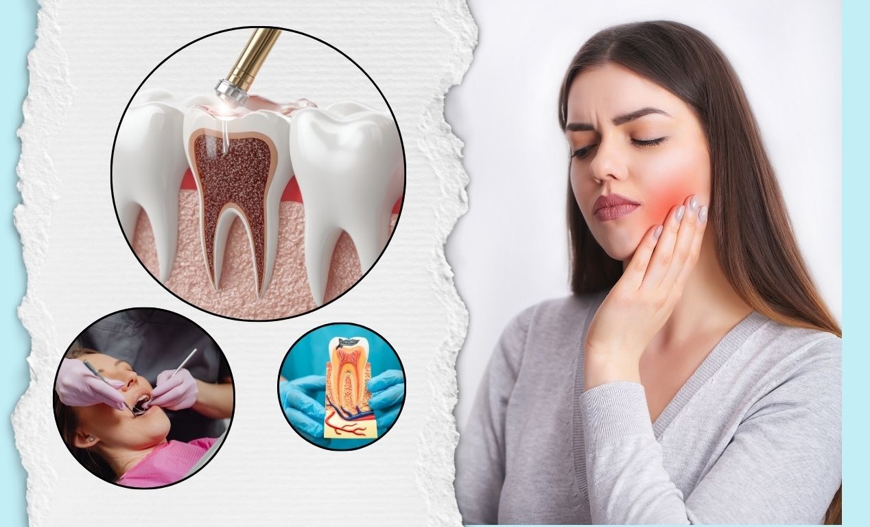 Root Canal Treatment in St. Clair, MO